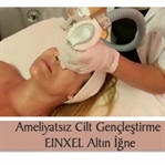 Ameliyatsız Cilt Gençleştirme-Altın İğne
