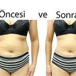 Bel ve baseni inceltecek diyet listesi