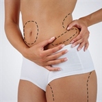 Lazerli Liposuction Sayesinde Kilo Verebilirsiniz