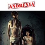 Anoreksiya Nedir? Anoreksiya Belirtileri ve Tedavi