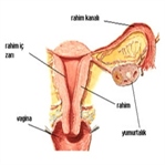 Pelvis İltihabı Ve Peritonit Nedir?