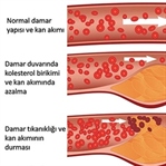 Kolestrolü düşürmek için ne yapmalı?
