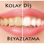 Pratik Bilgi Önerisi: Kolay Diş Beyazlatma