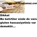 BU BELİRTİLER SİZDE DE VARSA GLUTEN HASSASİYETİNİZ