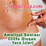 Ameliyat Sonrası Ciltte Oluşan Yara İzleri