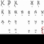 Erkek Nesli Gerçekten Yok Olacak mı?