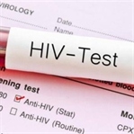 HIV Virüsü Nedir ve Nasıl Bulaşır ?