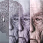 Demans Nedir? Belirtileri, Aşamaları ve Tipleri