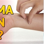 Egzama nedir? Türleri, Belirtileri ve Tedavisi