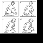 Epilepsi(Sara) Nedir, Türleri Nelerdir?