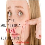Siyah nokta kabusuna doğal çözümler