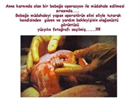Dokunmanın Gücü...yüzyılın Fotoğrafı..