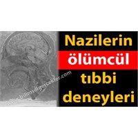 Nazilerin Ölümcül Tıbbi Deneyleri