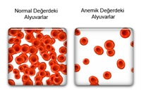 Demir Eksikliği Nasıl Giderilir ?