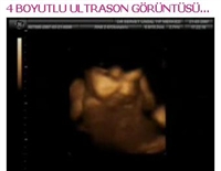 Anne Karnında 4 Boyutlu Ultrason Görüntüsü...
