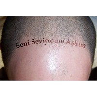 Sevgililer Gününde Saç Ekimi Hediye Etmek