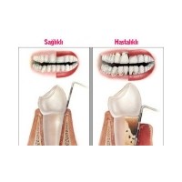 Ağız Ve Diş Sağlığı Hakkında Bilinmesi Gerekenler?
