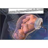 Vajinal Doğum Sancısız Yapılabilir