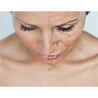 Cilt Lekelerini Geçiren Maske
